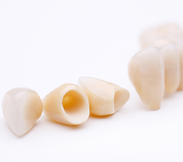 Sylmar Dental Crowns and Dental Bridges