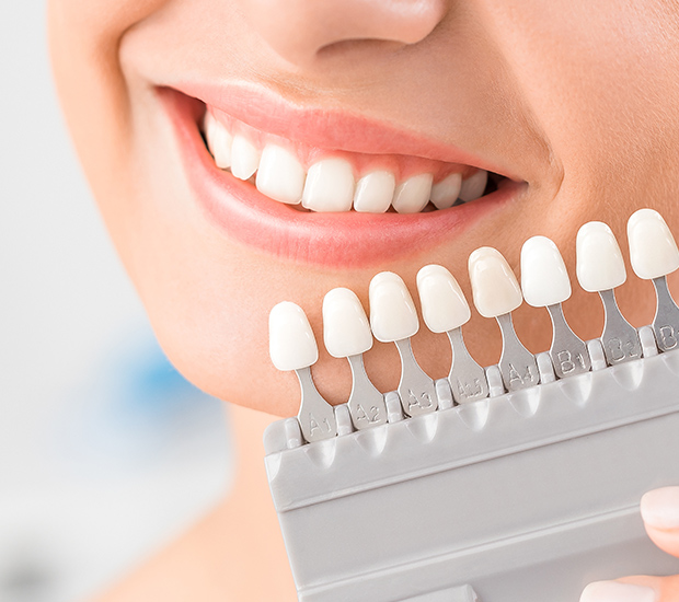 Sylmar Dental Veneers and Dental Laminates