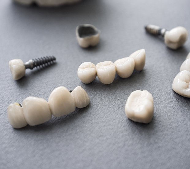 Sylmar The Difference Between Dental Implants and Mini Dental Implants