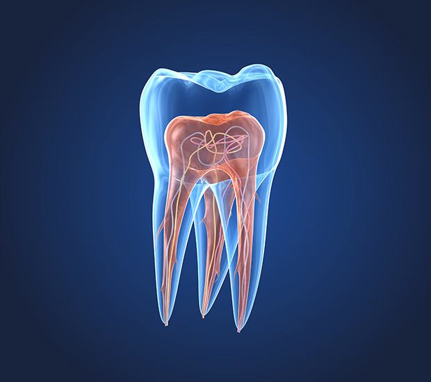 Sylmar What is an Endodontist